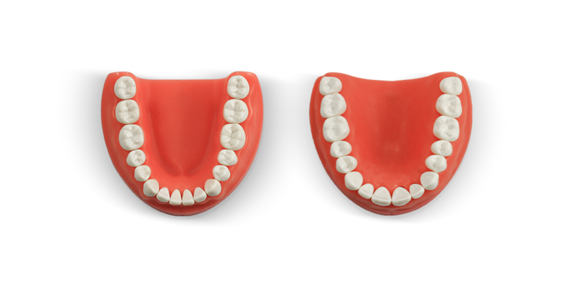 ModuPRO One Upper and Lower Gums with M300 teeth