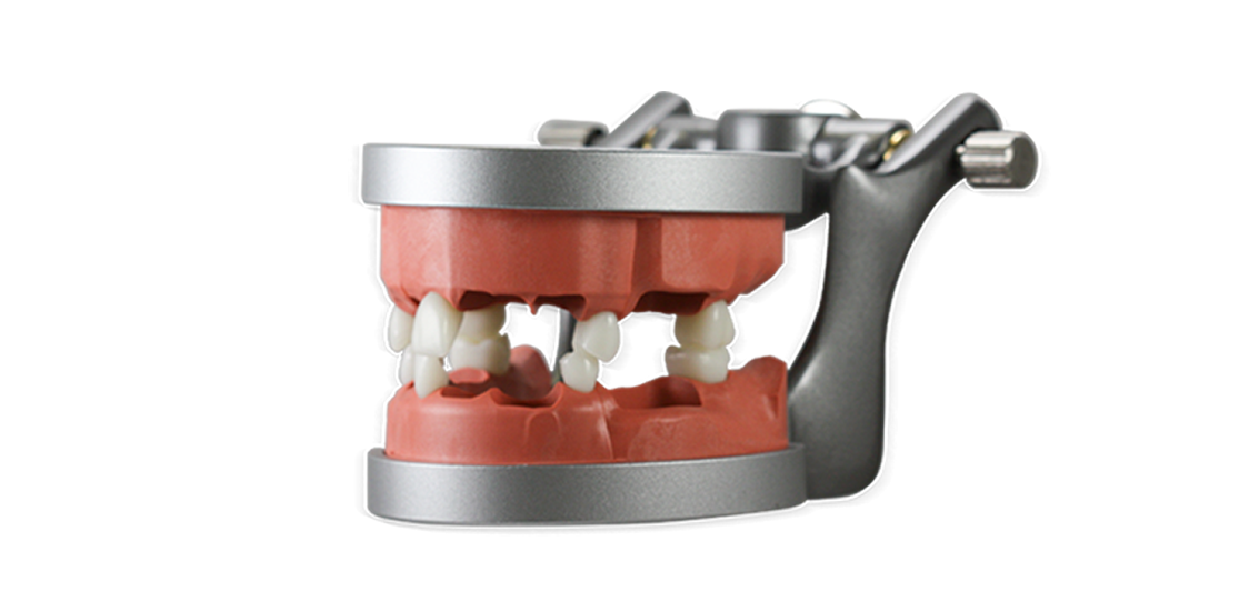 ModuPRO Endo kit E120 typodont in articulator for WREB practice and preparation.