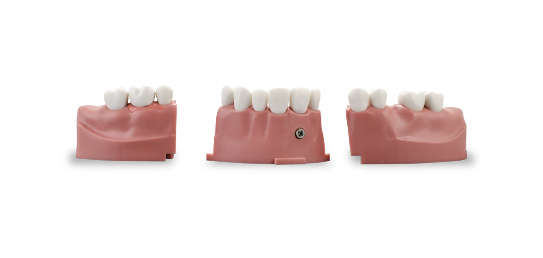 ModuPRO One Upper and Lower Gums with M300 teeth