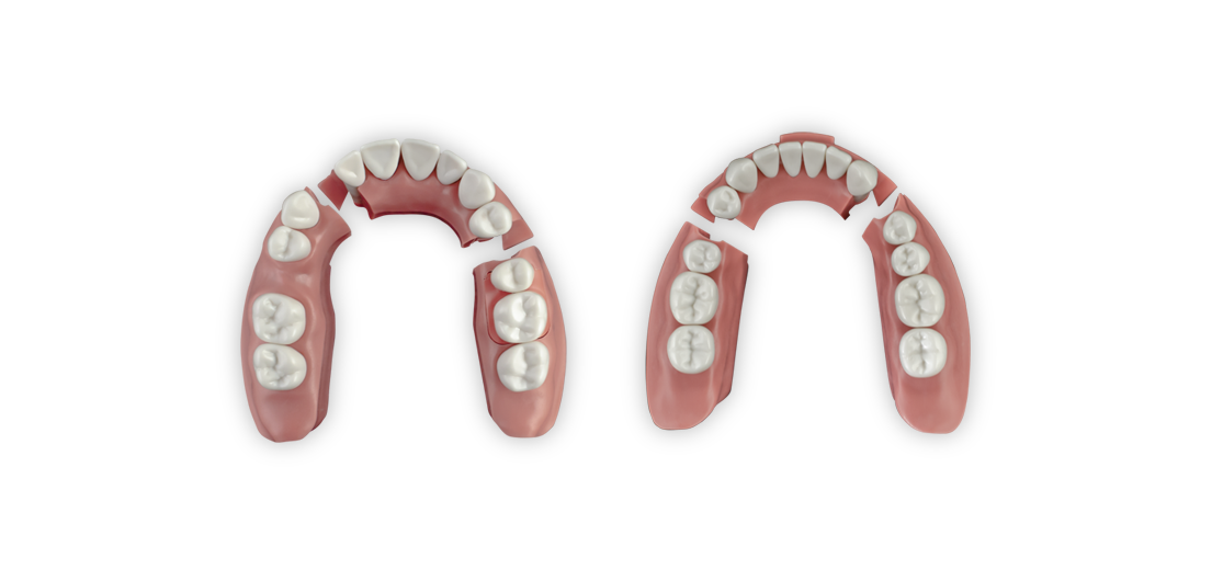 ModuPRO One Upper and Lower Gums without teeth